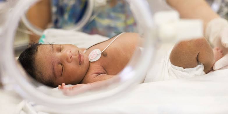 A sick baby in hospital 